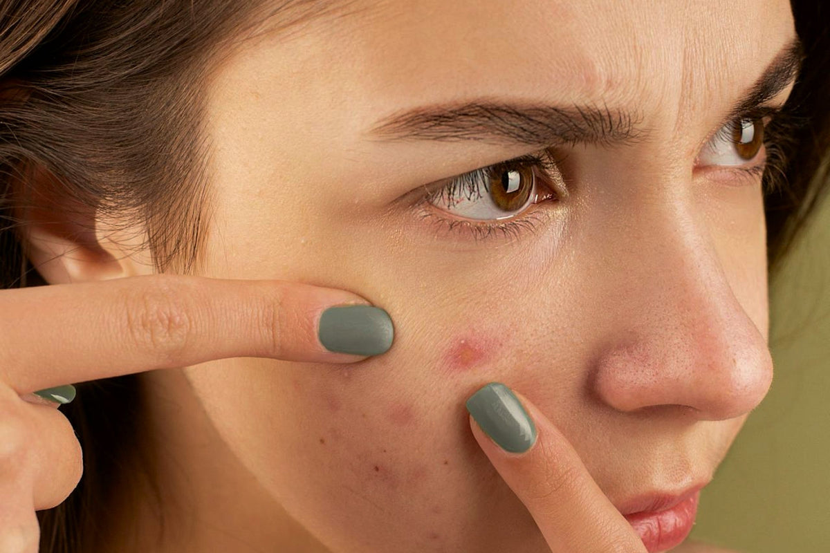 Skin and hair affected by hard water